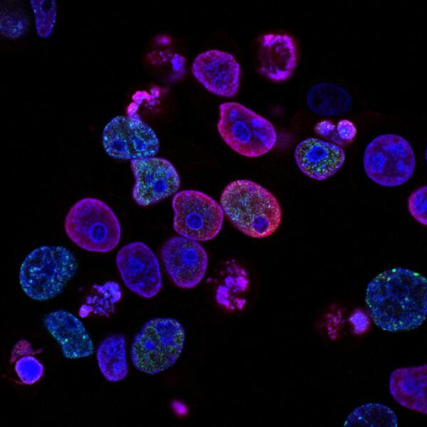 Reducing PMA-induced <em>COX-2</em> expression using a herbal formulation in MCF-7 breast cancer cells