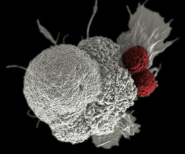 Application of gene therapy for reversing T-cell dysfunction in cancer