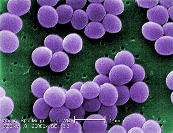 Improving Wound Healing by Breaking Down Biofilm Formation and Reducing Nosocomial Infections