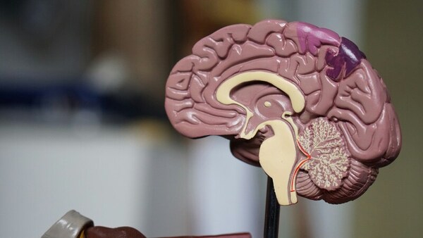 A statistical analysis and generalized linear models of cerebral stroke