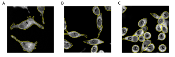 Investigating the effects of glucose reintroduction on acutely starved HeLa cells