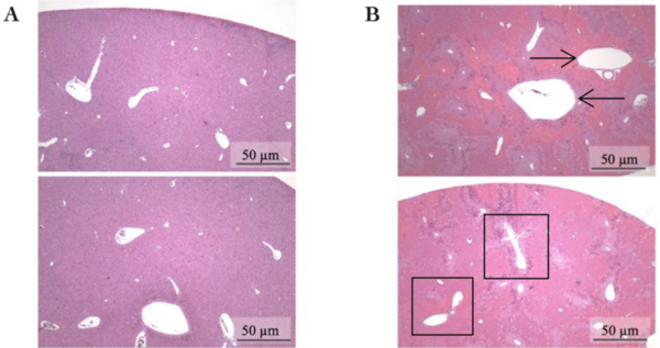 Evaluation of hepatotoxicity from excessive acetaminophen: physiological and histological changes