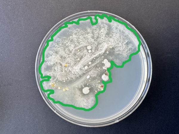 Bacterial contamination on New York City transit and the effectiveness of hand hygiene